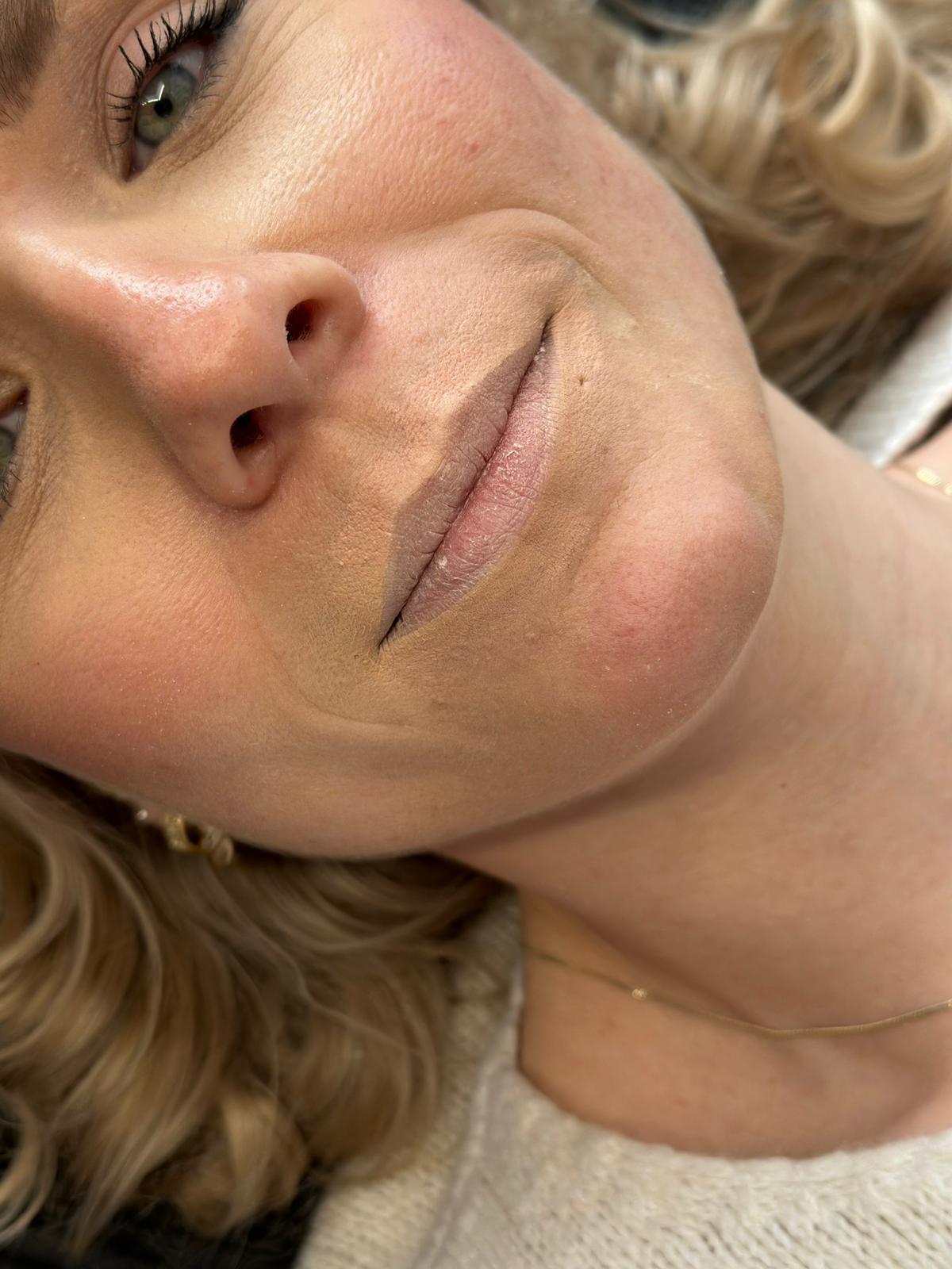 Lippen vorher
